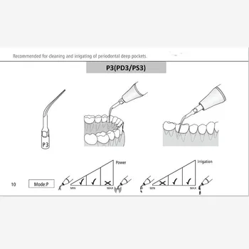 5kusů PD3 zubní scaler tipy stomatologické zařízení bělení zubů, ultrazvukový zubní scaler tip PD3 pro SATELEC NSK GNATUS DTE