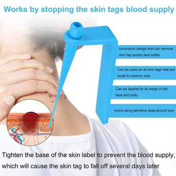 Micro TagBand Kůže Tag Remover Zařízení pro Malé až Střední Pleť Značky čisticích Tamponů Dospělé Krtek, Bradavice Péče o Obličej Lékařské Kůže Tag