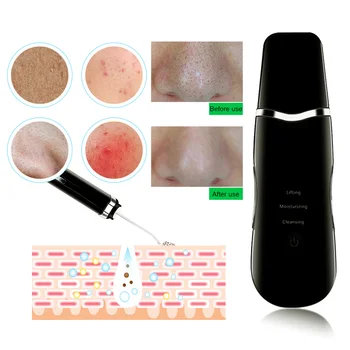 Ultrazvukový Skin Scrubber Obličeje Špachtle Deap Čištění Kůže Peeling Obličeje Čistší RF EMS LED Krásu Zařízení Péče o Pleť Spreje